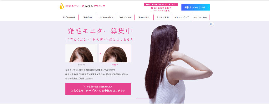 新宿レディースAGAクリニック｜【2025年最新】東京都のFAGAにおすすめのクリニック16選｜主な女性薄毛治療法も