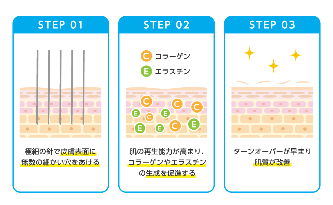 ダーマペン