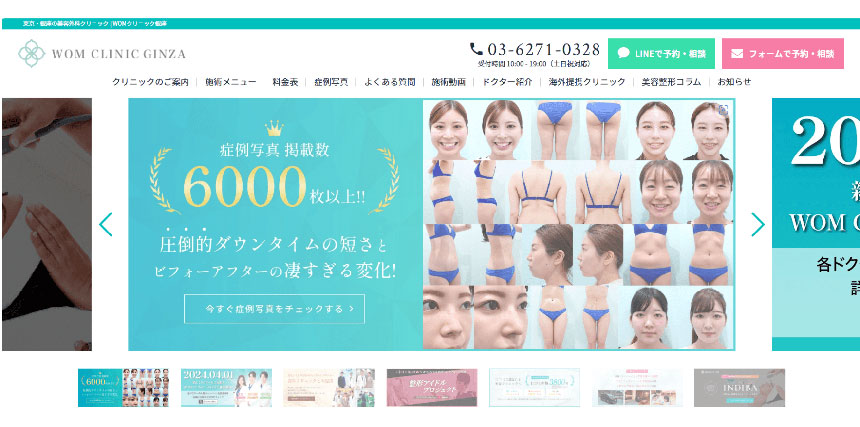銀座周辺の脂肪吸引 おすすめ5選｜顔・二の腕・太ももが気になるあなたに【2025年最新】 WOM CLINIC GINZA