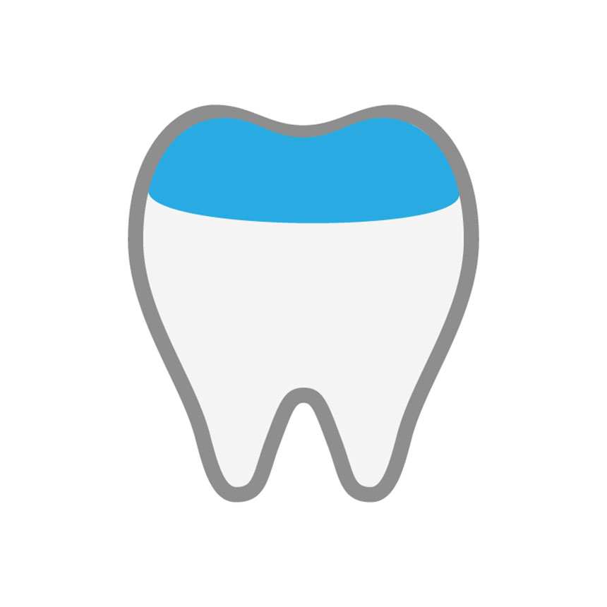 セラミックオンレー｜大阪市のセラミック治療｜おすすめ歯科クリニック16選