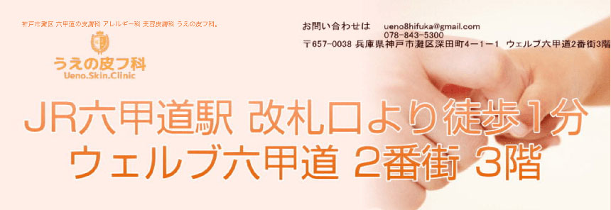 神戸市のニキビ治療におすすめのクリニック5選 うえの皮フ科