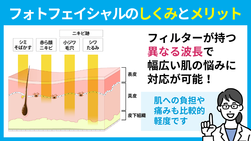 フォトフェイシャルの種類：利用方法とポイント｜横浜市のフォトフェイシャルにおすすめのクリニック10選｜仕組みについても解説