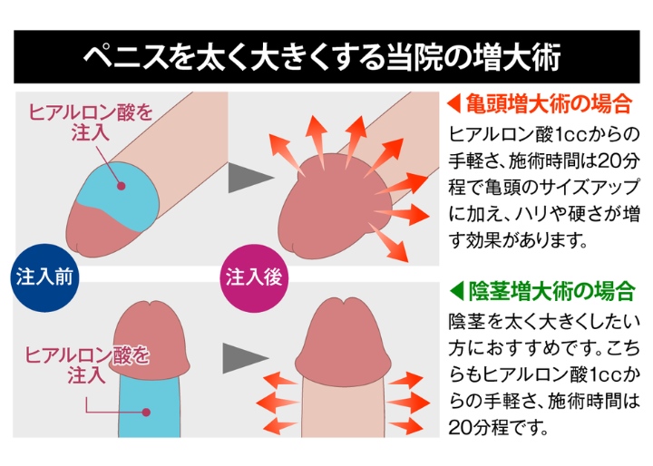 さいたま市大宮区の亀頭増大術 おすすめのクリニック5選|MSクリニック 大宮