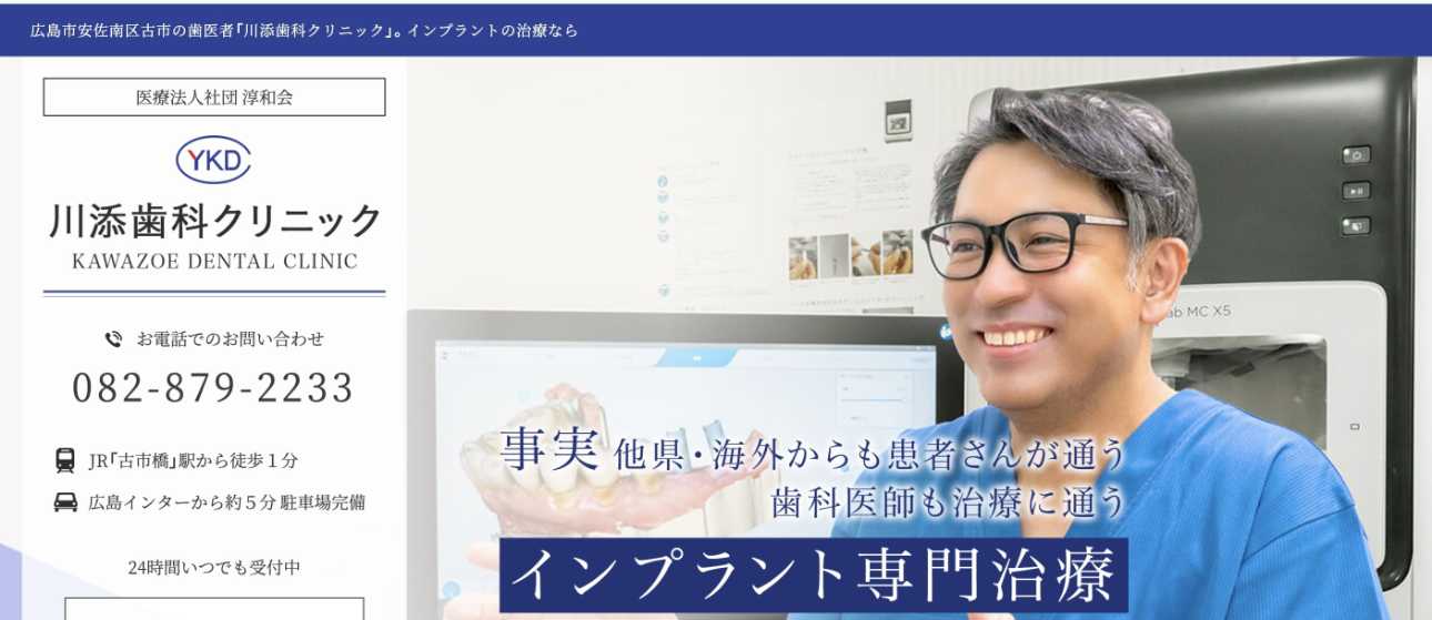 【2025年最新】広島市のインプラント治療におすすめの歯科クリニック10選|川添歯科クリニック