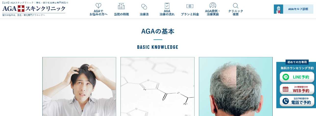 【2025年最新】静岡市のAGA(薄毛治療)におすすめのクリニック11選|AGAスキンクリニック 静岡院