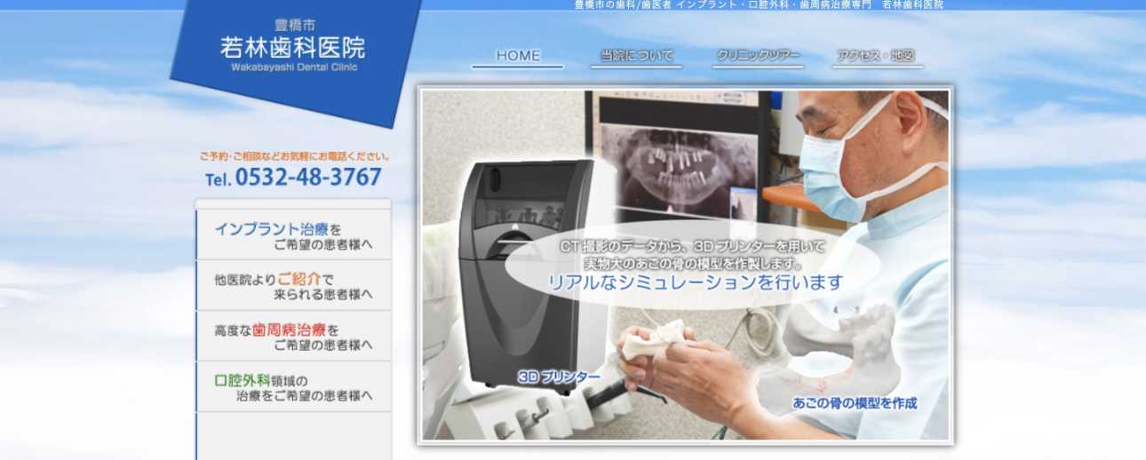 【2025年最新】豊橋市のインプラント治療におすすめの歯科クリニック10選|若林歯科