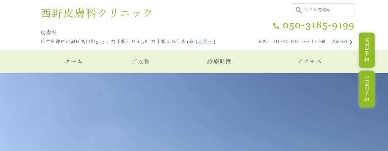 神戸市のAGA・薄毛治療クリニック おすすめ16選|後悔しないための基礎知識|西野皮膚科クリニック