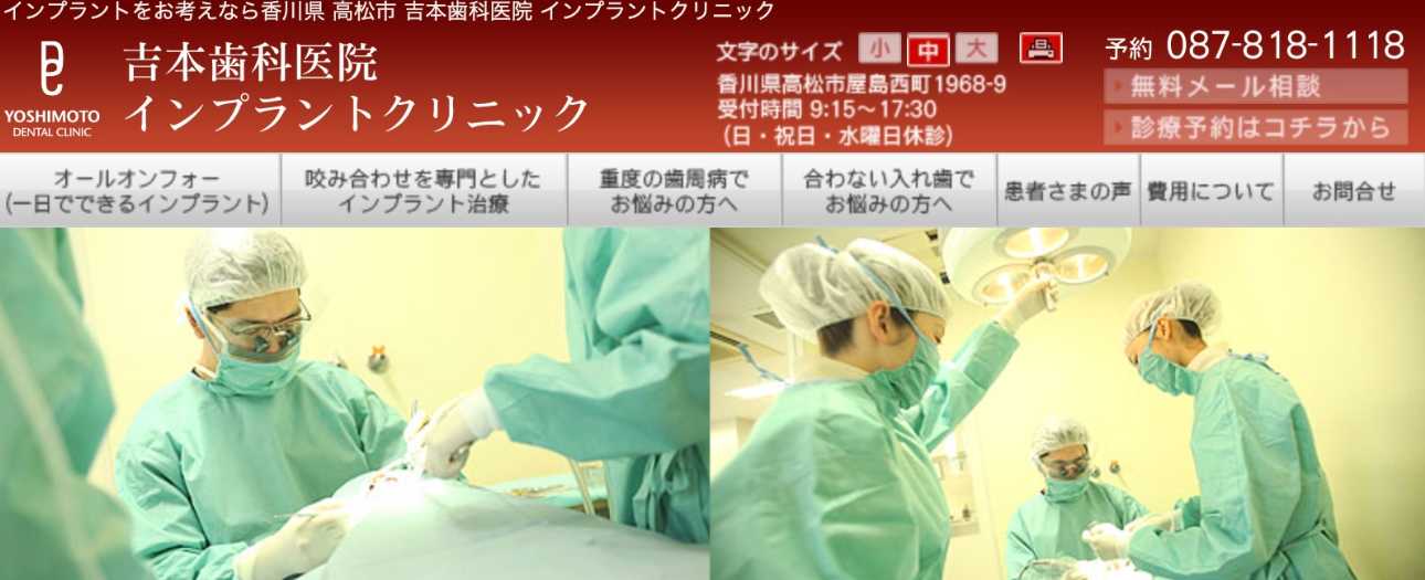 【2025年最新】高松市のインプラント治療におすすめのクリニック10選|吉本歯科医院