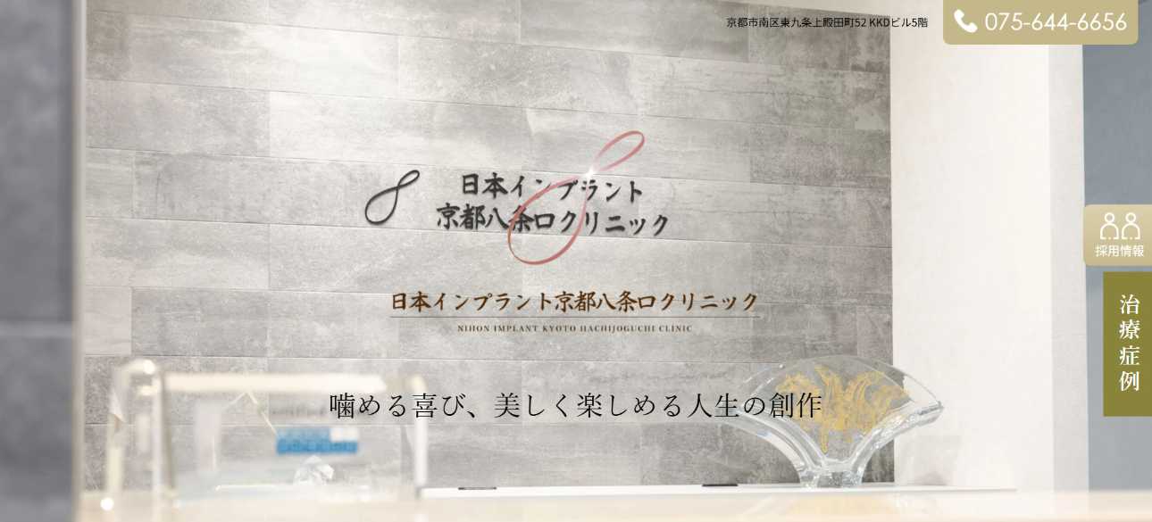 【2025年最新】京都府のインプラント治療におすすめの歯科クリニック10選|日本インプラント京都八条口クリニック
