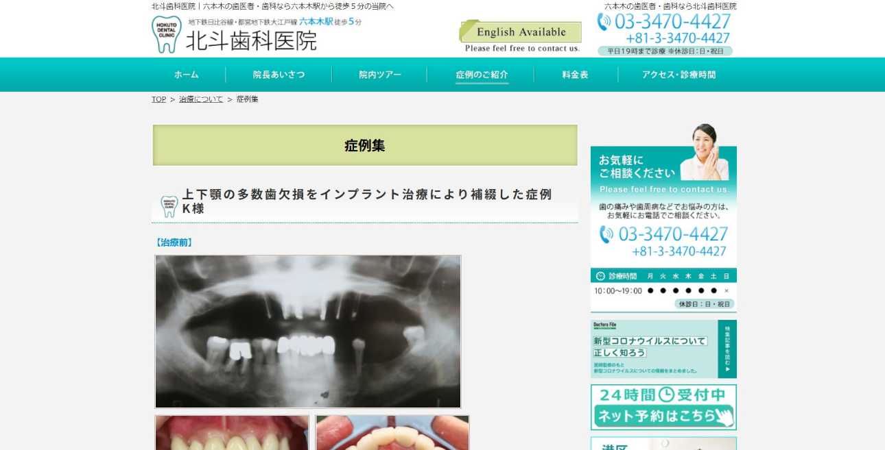 【2025年最新】六本木周辺の矯正歯科治療(歯列矯正)におすすめの歯科クリニック10選|北斗歯科医院