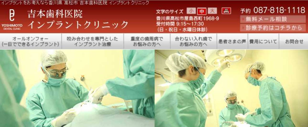 【2025年最新】香川県のインプラント治療におすすめの歯科クリニック10選|吉本歯科医院