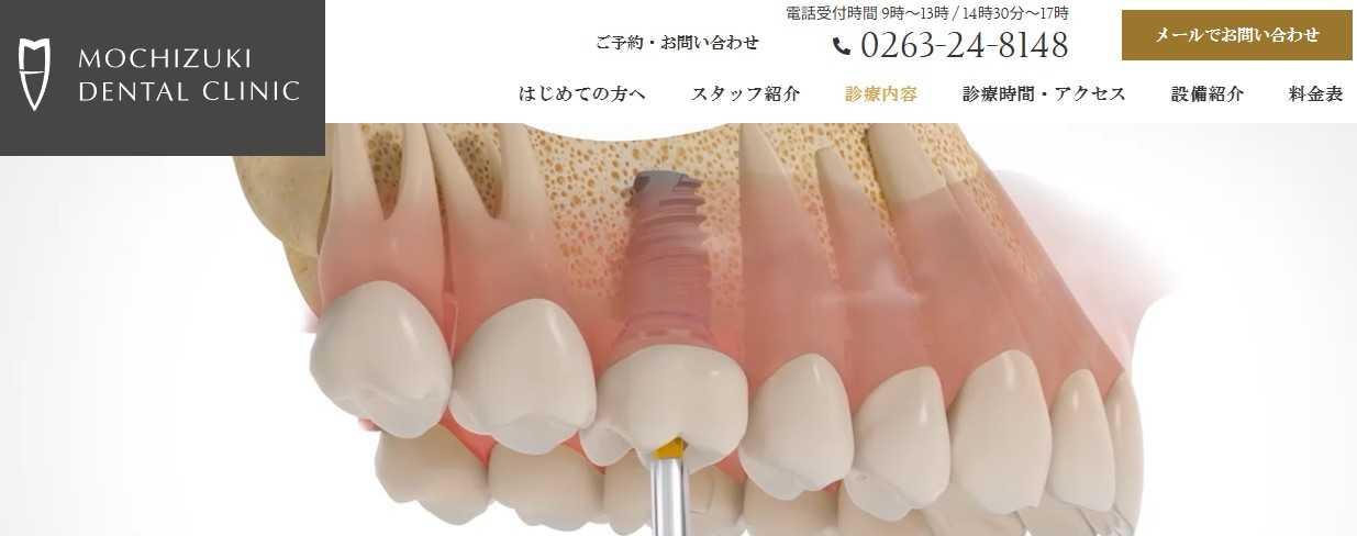 【2025年最新】長野県のインプラント治療におすすめの歯科クリニック10選|望月デンタルクリニック