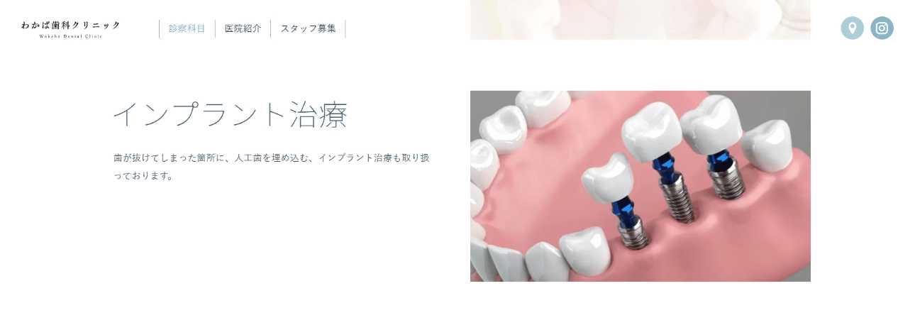 【2025年最新】北千住のインプラント治療におすすめの歯科クリニック10選|わかば歯科クリニック