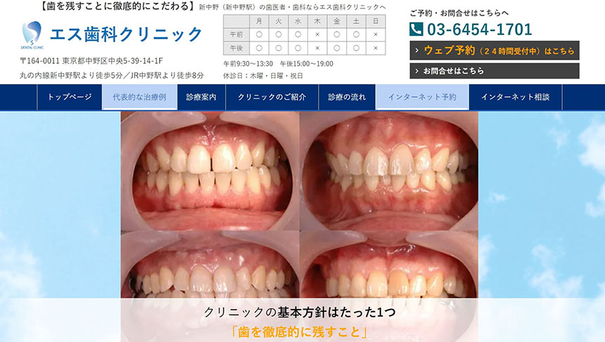中野区の歯周病治療におすすめの歯科クリニック5選 エス歯科クリニック
