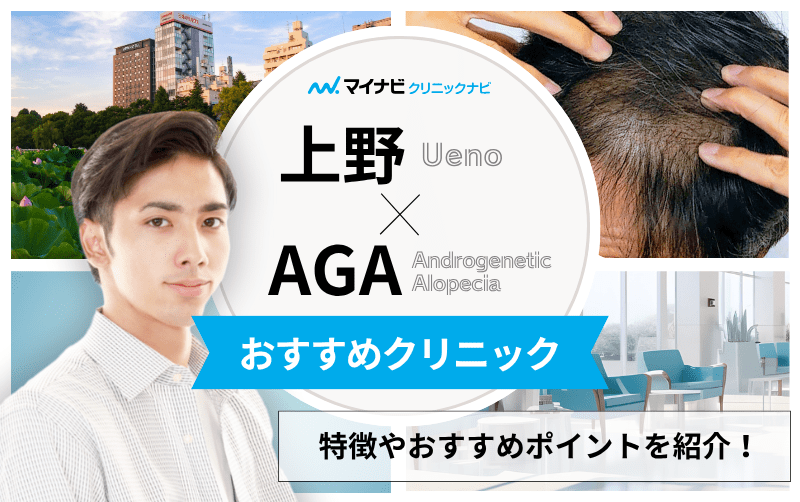 上野のAGA・薄毛治療クリニック おすすめ5選｜後悔しないための基礎知識