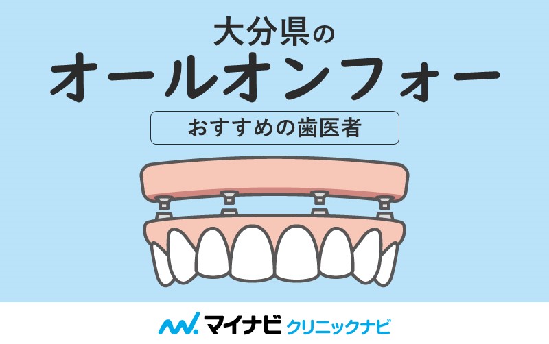 大分県のオールオンフォーにおすすめの歯科クリニック6選