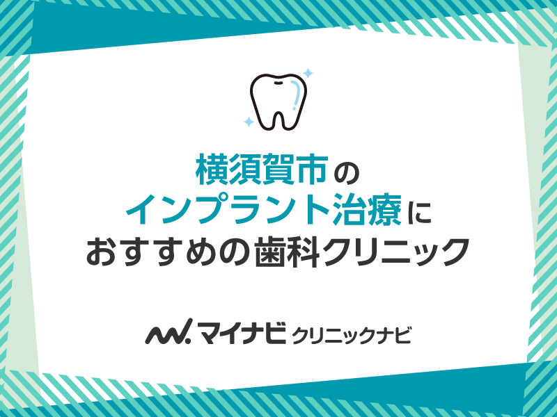 横須賀市のインプラント治療におすすめの歯科クリニック5選