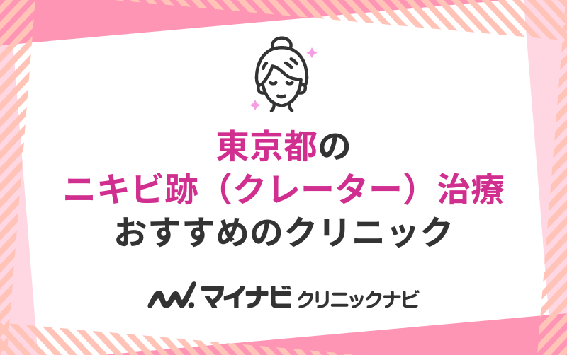 東京都のニキビ跡（クレーター）治療におすすめのクリニック9選