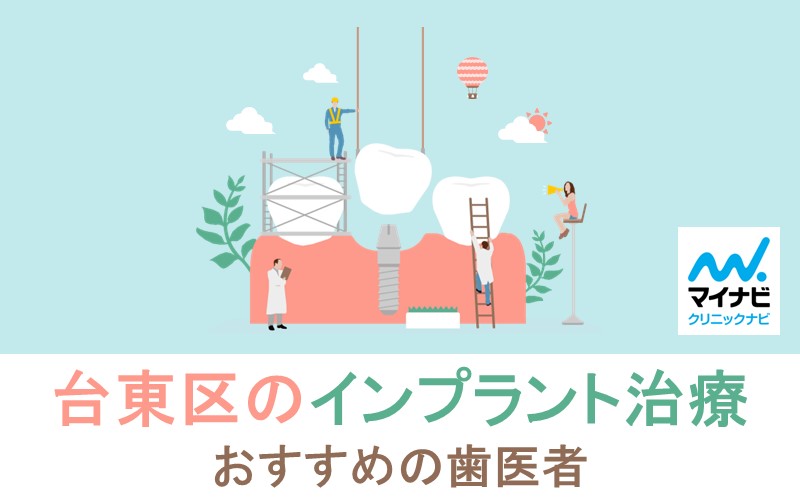 台東区のインプラント治療におすすめの歯科クリニック5選