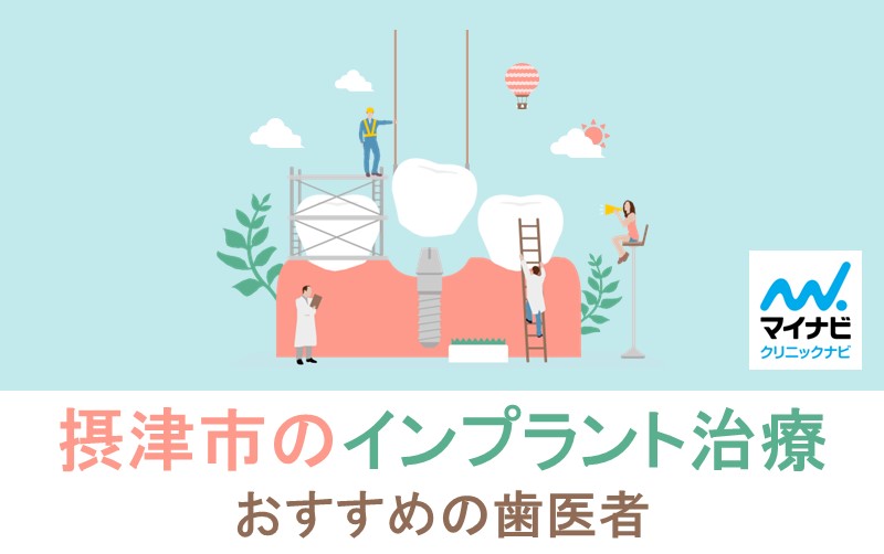 摂津市のインプラントにおすすめの歯科クリニック5選