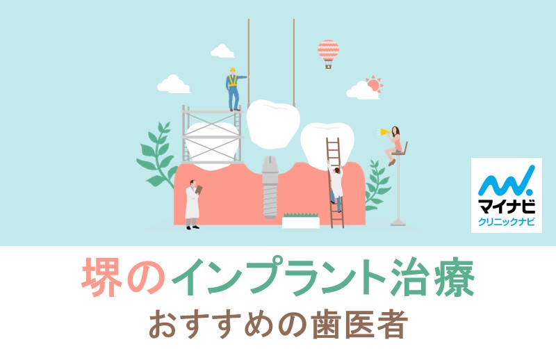 【2025年最新】堺市のインプラント治療におすすめの歯科クリニック10選堺市のインプラント治療におすすめの歯科クリニック10選