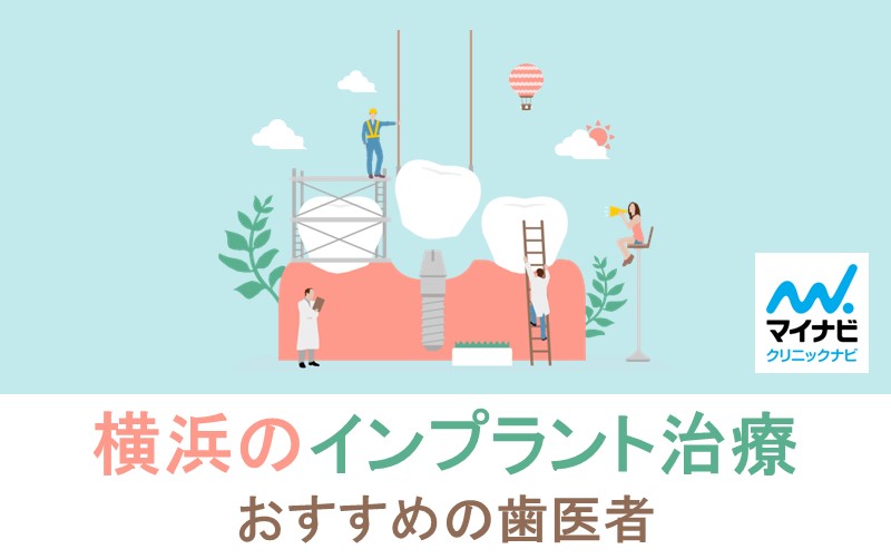 横浜市のインプラント治療におすすめの歯科クリニック10選