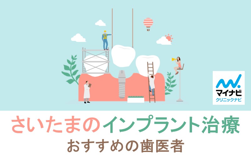さいたま市のインプラント治療におすすめの歯科クリニック10選