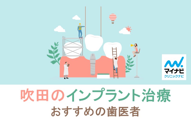 吹田市のインプラント治療におすすめの歯科クリニック5選