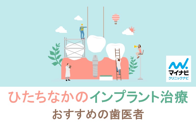 ひたちなか市のインプラント治療におすすめの歯科クリニック5選